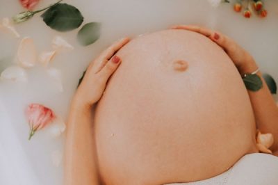 cremas antiestrías embarazo